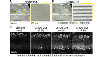 九州大學等實現活體小鼠大腦透明化，在維持正常功能的同時進行螢光觀察