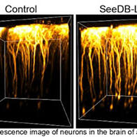 九州大學開發出可使活體組織透明化的試劑，防止光線折射和散射