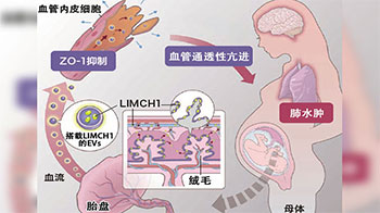 名古屋大學揭示早髮型子癇前期發病機製，胎盤來源的細胞外囊泡蛋白參與疾病進程