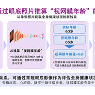 日本東北大學的AI技術，僅用一張眼底照片即可推算出反映身體年齡的「視網膜年齡」