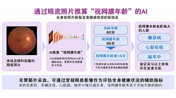 日本東北大學的AI技術，僅用一張眼底照片即可推算出反映身體年齡的「視網膜年齡」