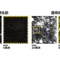 九州大學：實現活體哺乳動物生物組織的透明化及觀察，通過調節細胞外液的折射率來推動神經科學發展
