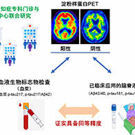 新潟大學等證實血液標誌物「p-tau217」可高精度檢測腦內β澱粉樣蛋白蓄積，為低侵襲、高效率的阿茲海默症診斷開闢道路