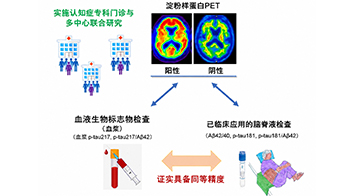 新潟大學等證實血液標誌物「p-tau217」可高精度檢測腦內β澱粉樣蛋白蓄積，為低侵襲、高效率的阿茲海默症診斷開闢道路