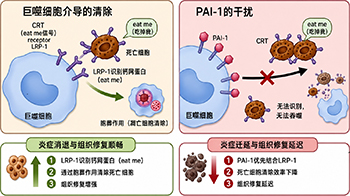 東海大與東北大闡明炎症遷延的生理機制， PAI-1抑制有望應用於炎症性疾病及組織再生治療