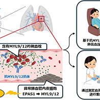 千葉大學鑑定出導致難治性疾病「肺高血壓症」惡化的蛋白質「MYL9/12」，會引發血管結構惡化