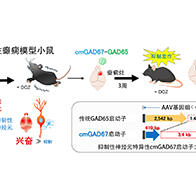 群馬大學開發針對難治性癲癇的新型基因療法，利用超小型GAD67啟動子抑制發作