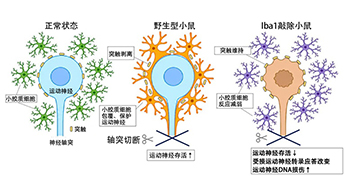 慶應義塾大學闡明腦內「游擊手」小膠質細胞包裹保護受損神經細胞的機制，有望用於開發阿茲海默症等疾病療法