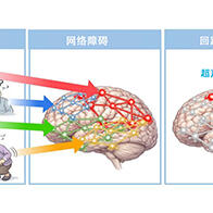 QST闡明tau蛋白病變通過腦回路引發認知症狀，有望實現失智症預測與靶向迴路治療