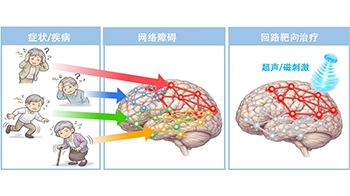 QST闡明tau蛋白病變通過腦回路引發認知症狀，有望實現失智症預測與靶向迴路治療