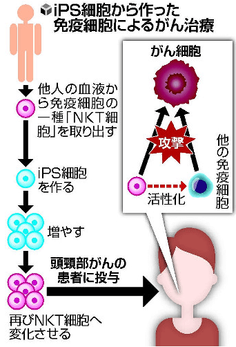 日本iPS細胞研究報告(廿一) 理研篇：癌症免疫細胞療法臨牀試驗