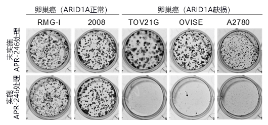 日本發現冶癒ARID1A基因突變癌症的新方法