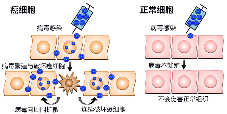 以毒攻毒，東京大學成功使用疱疹病毒冶癒腦腫瘤，一年生存率達92.3%