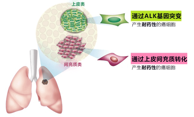 金澤大學查明肺癌細胞的分子靶向藥物抗藥性機制