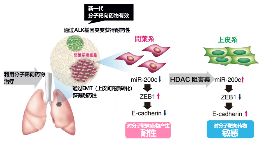 金澤大學查明肺癌細胞的分子靶向藥物抗藥性機制