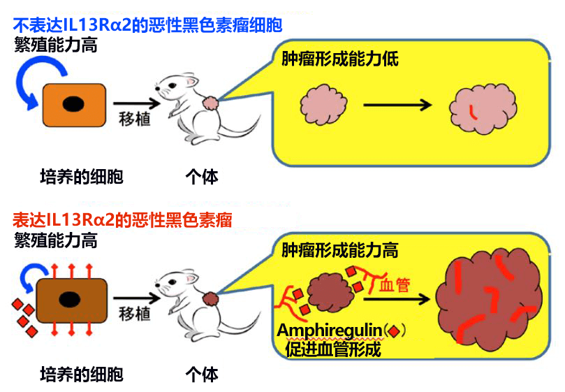 東京醫科齒科大學與東京大學發現IL13Rα2導致惡性黑色素瘤惡化的機制