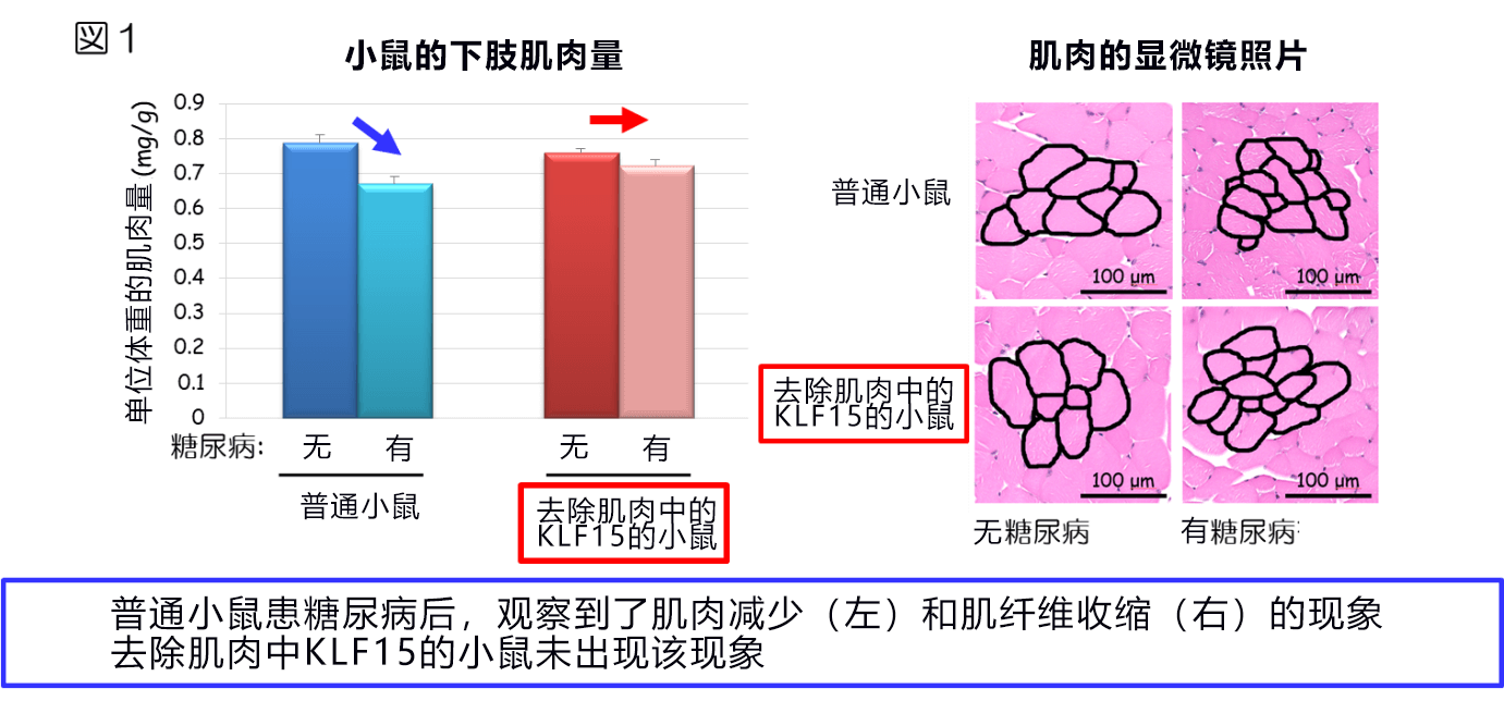 糖尿病患者爲啥會瘦？神戶大學查明糖尿病導致肌肉減量的機制