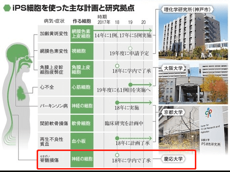 日本iPS細胞研究報告(廿四)慶應大學篇：脊髓傷害臨牀試驗開始