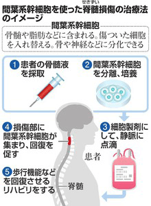 日本iPS細胞研究報告(廿四)慶應大學篇：脊髓傷害臨牀試驗開始