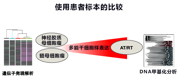 日本京都大學與東京大學利用人源iPS細胞製作腦腫瘤模式，查明兒童腦腫瘤病理