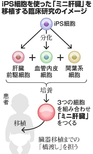 日本iPS細胞研究報告(廿六) 橫濱市大篇：肝芽移植臨牀申請