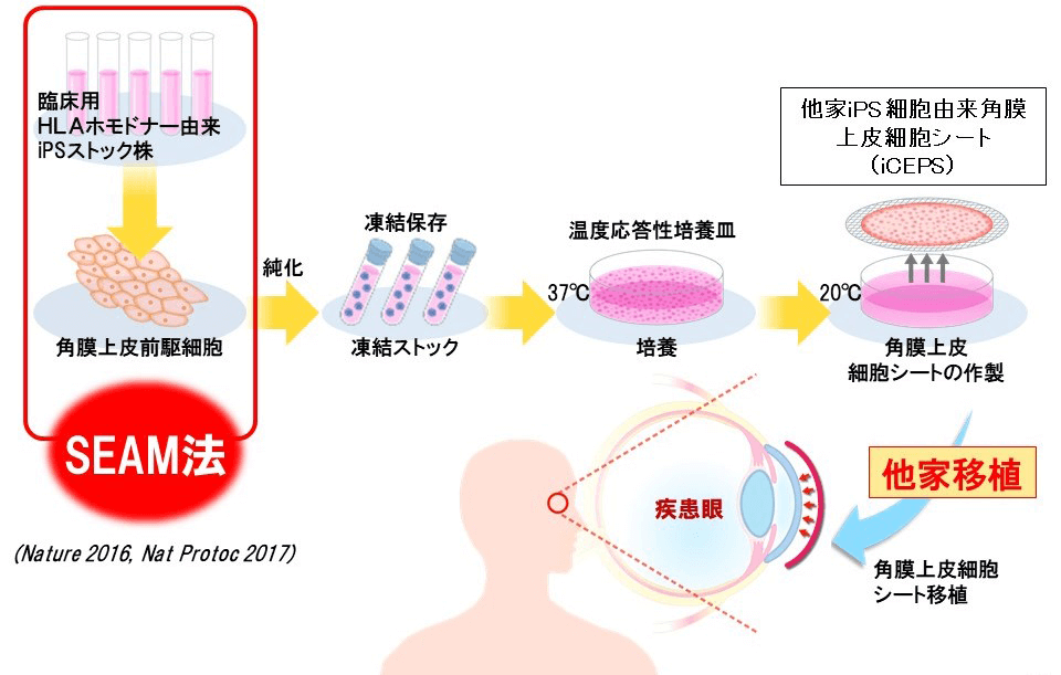 日本iPS細胞研究報告(廿七) 阪大篇：世界首例iPS角膜移植