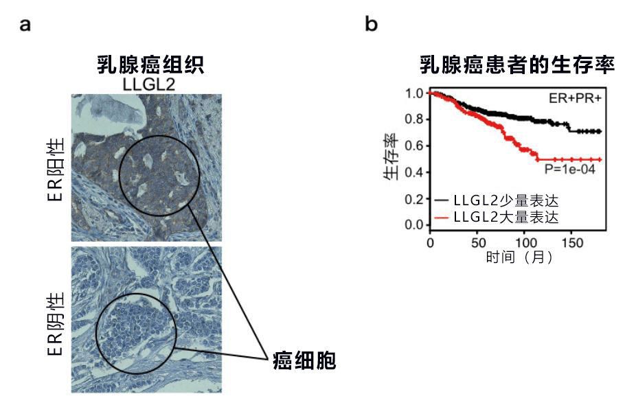 日美共同發現誘導乳房癌細胞繁殖和導致藥物失效的關鍵蛋白質