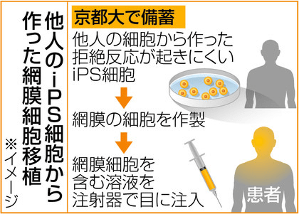 日本iPS細胞研究報告(廿九) 理研篇：應答視網膜移植試驗安全