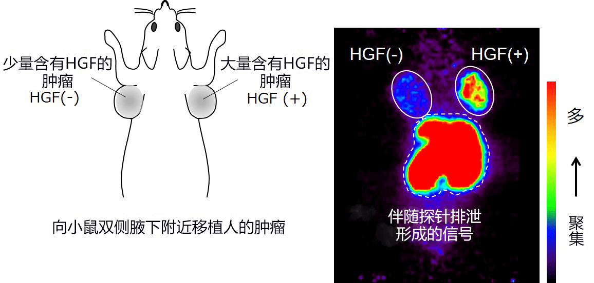 日本發現有助於診斷和冶癒癌症的環肽