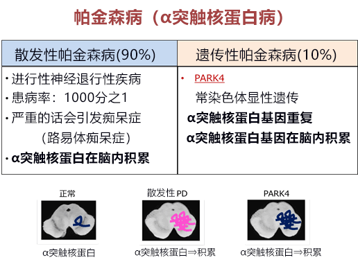 日本開發新型核酸藥物，向根治巴金森氏症邁進一大步