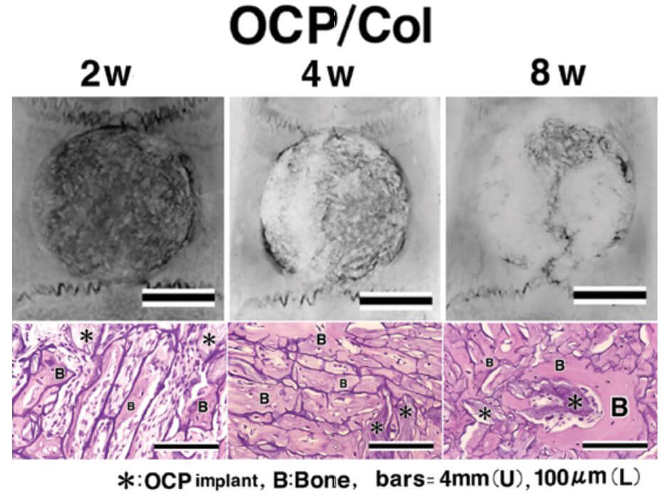 日本東北大學開發的骨再生材料產品化，可用於齒科口腔外科領域的骨缺損開墾