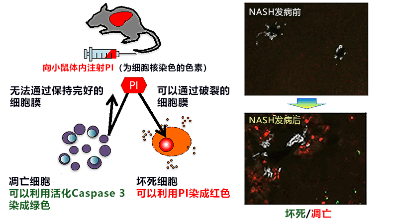 日本查明誘發脂肪肝隊形變換成肝炎的「鐵死亡」，爲預防和冶癒脂肪性肝炎鋪路