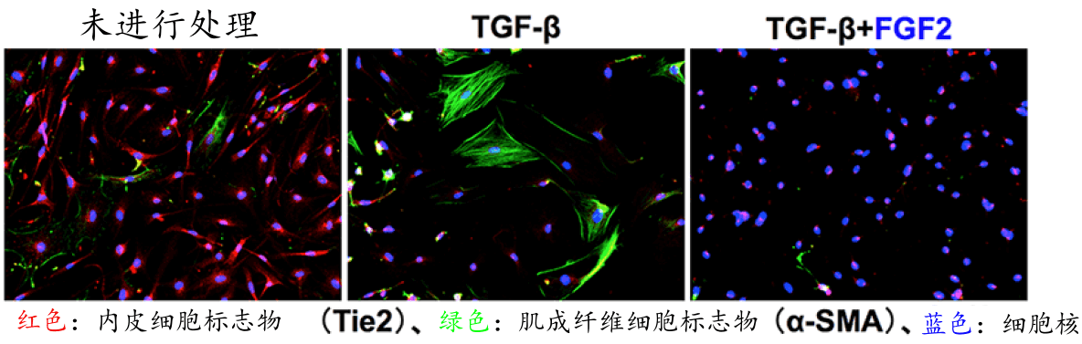 日本查明FGF2能抑制血管內皮細胞形成腫瘤相關纖維母細胞