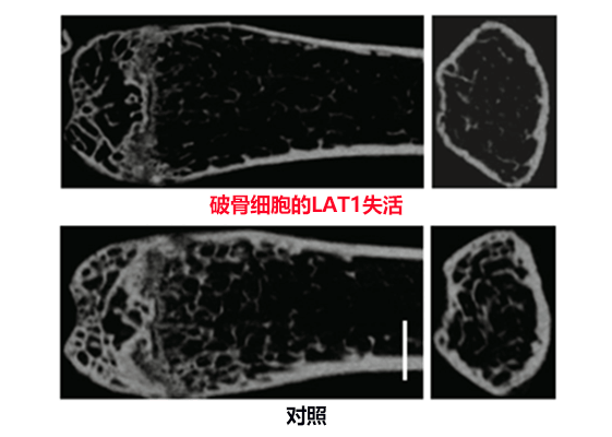 氨基酸對保持骨骼健康至關重要