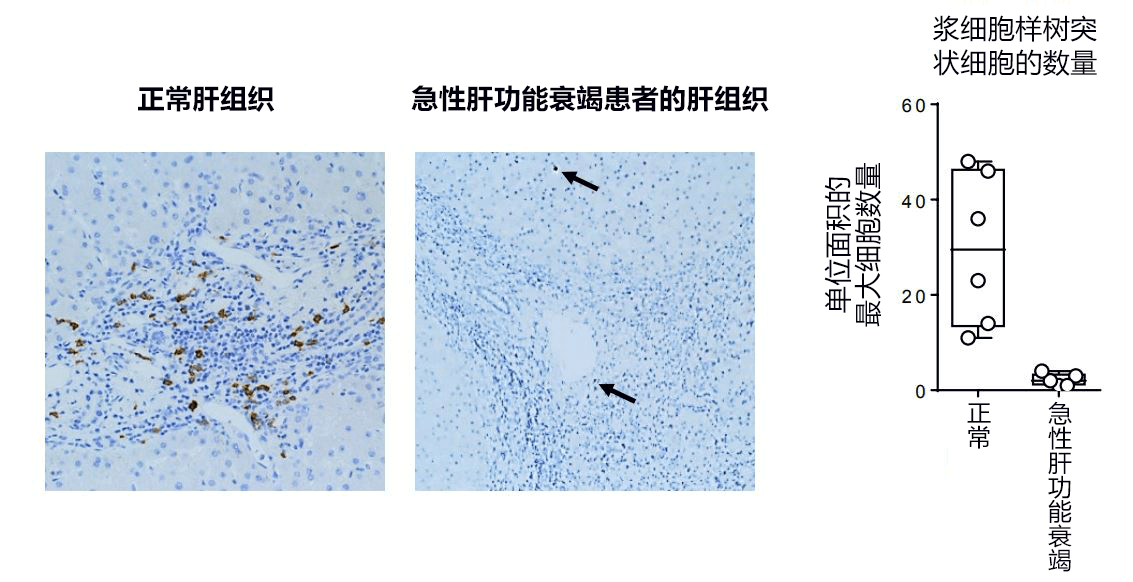 日本發現控制急性肝耗竭的新型免疫細胞，有望開發新冶癒方法