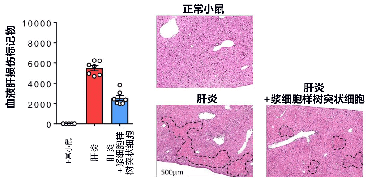 日本發現控制急性肝耗竭的新型免疫細胞，有望開發新冶癒方法