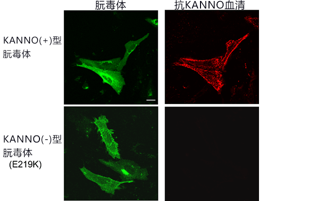 紅色是與朊毒體表達細胞結合的KANNO型抗體