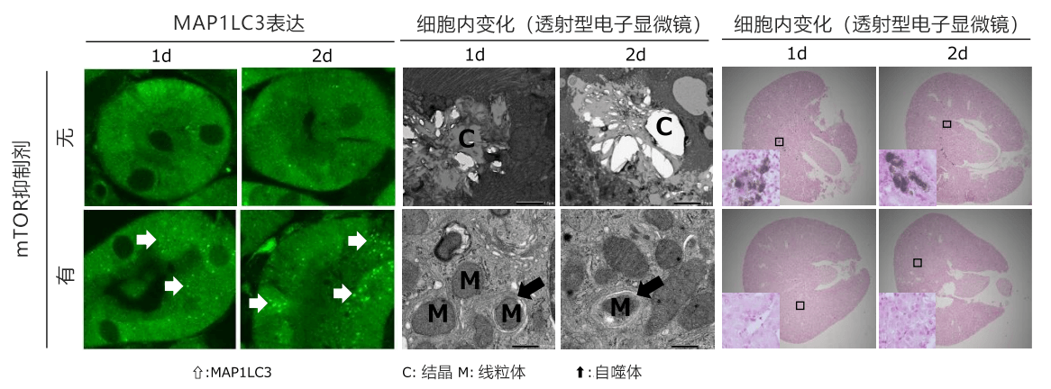 日本發現自噬功能降低會促進尿路結石形成