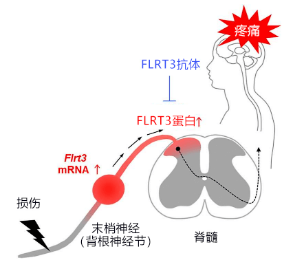 大阪大學確定FLRT3蛋白質會加劇神經性疼痛的疼痛感