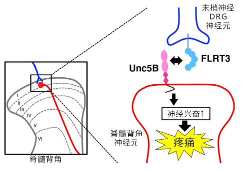 大阪大學確定FLRT3蛋白質會加劇神經性疼痛的疼痛感