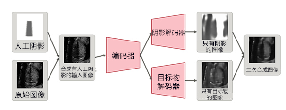 理研開發出透過B超判讀胎兒心臟病的AI技術