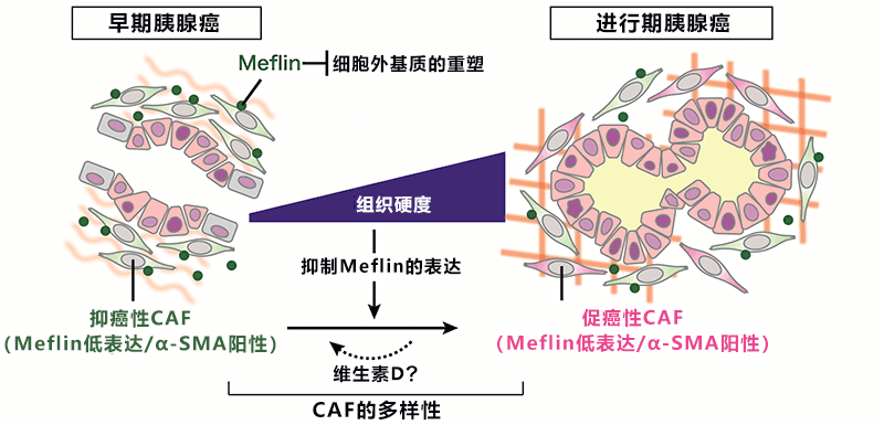 日本發現抑制胰腺癌惡化的新型細胞，有望開發改變癌細胞週遭環境的新療法