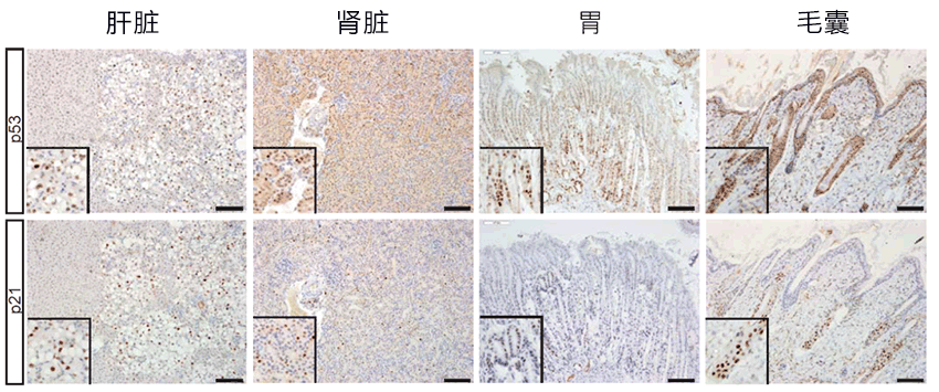 用細胞風化作用抑制癌變，有望開發新療法