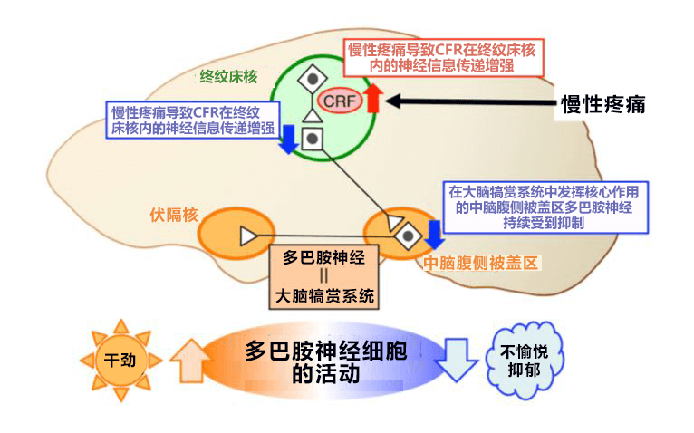 日本北海道大學查清慢性疼痛讓人心情沮喪的機制