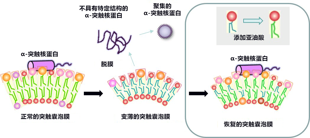 順天堂大學明確腦内脂質膜變化導致帕金森症的機制，食用亞麻油酸可預防神經細胞死亡