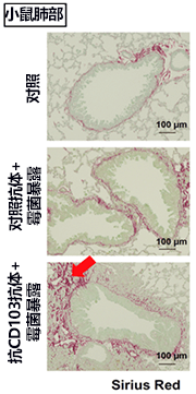 冶癒黴菌性肺纖維化的關鍵！日本明確導致肺部組織纖維化的新細胞羣