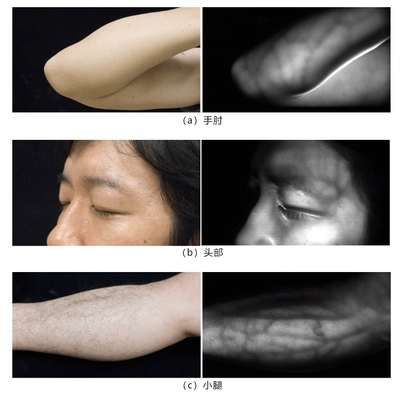 日本開發出非接觸即時清晰顯示皮下血管的技術，有望應用於注射、採血等醫療用途