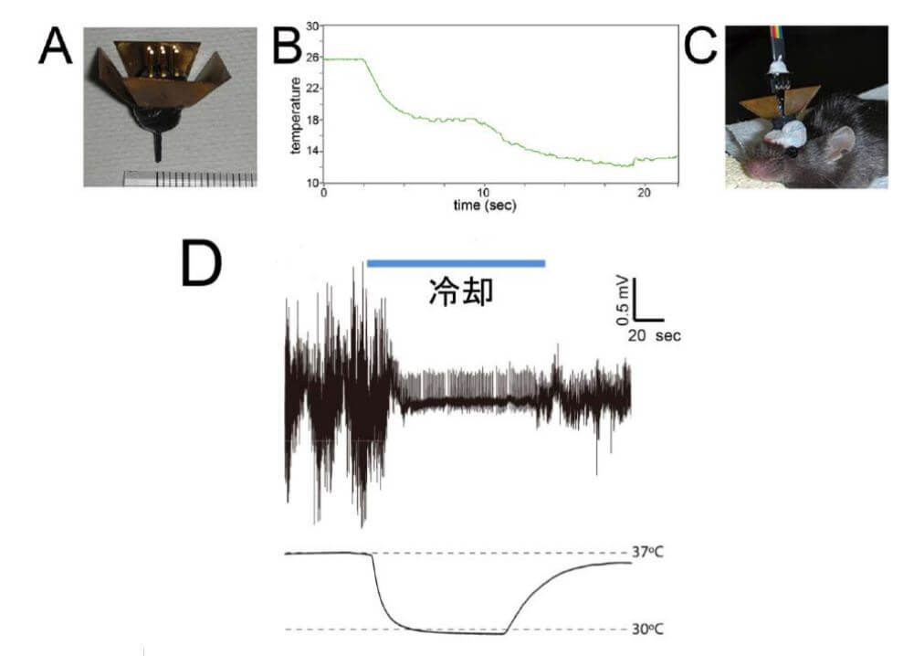 冷卻大腦治癲癇——日本查清癲癇病情惡化的分子機制