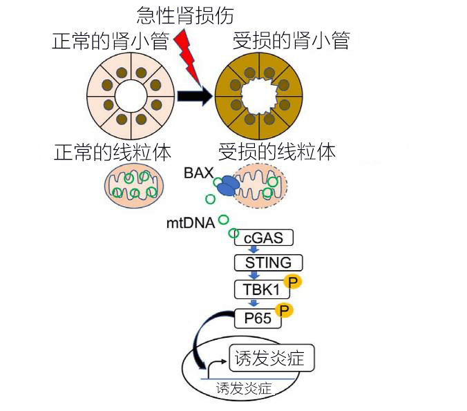 日本發現急性腎傷害（AKI）伴生發炎新機制