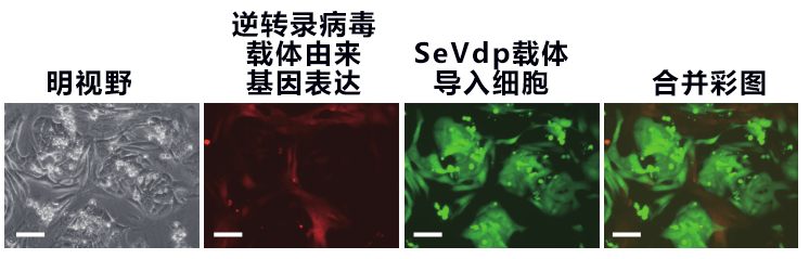 築波大學利用iPS細胞發現逆轉錄電腦病毒基因沉默新機制